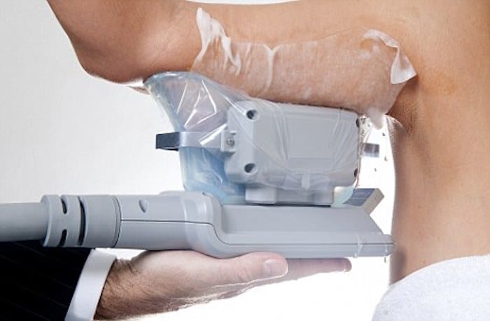 fat freezing arms Gateshead
