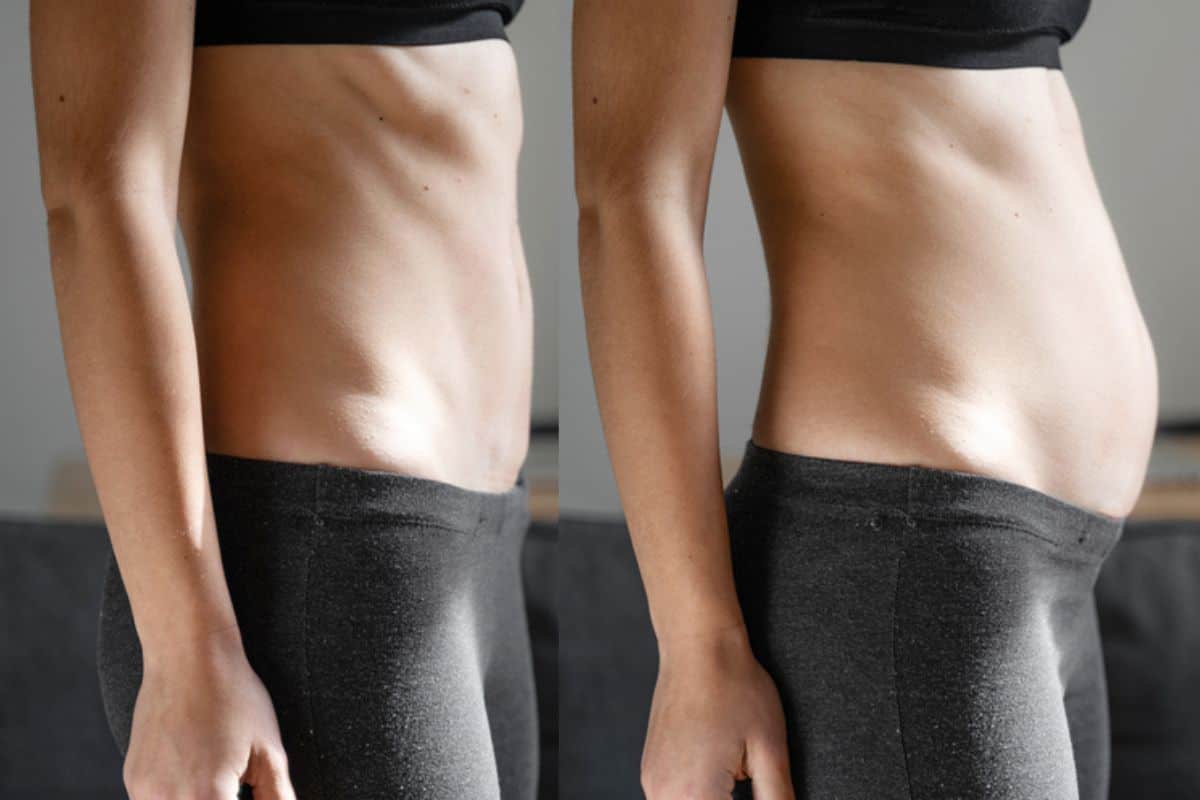 How long does diastasis recti take to improve Gateshead?