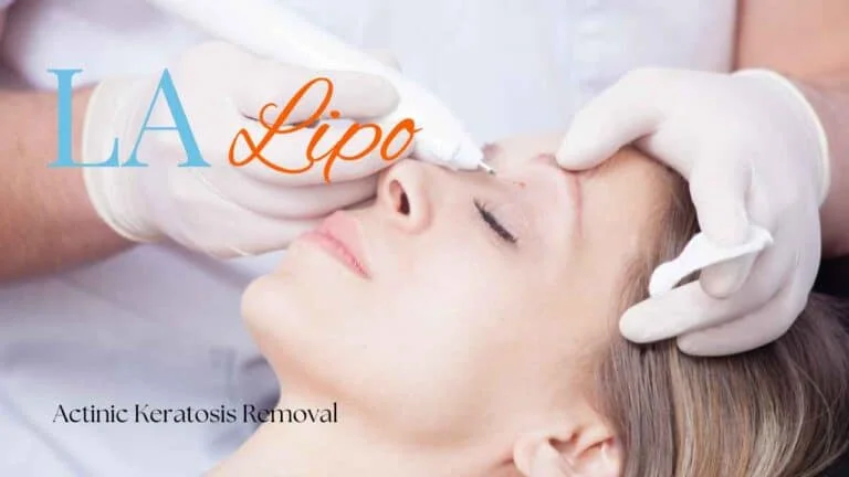 Woman receiving Actinic Keratosis Removal Treatment Gateshead