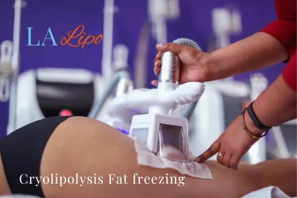 women getting fat freezing Gateshead