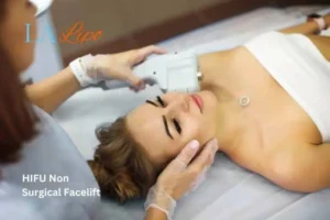 Woman having Hi-Fu to reduce wrinkles Gateshead.
