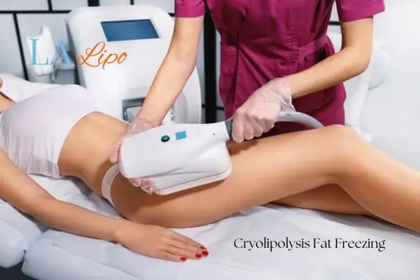 Woman receiving coolsculpting Gateshead treatment on her thighs