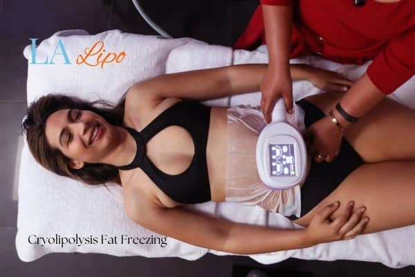 woman getting cryolipolysis Gateshead