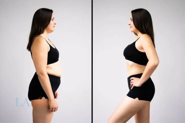 link between body image and mental health Gateshead