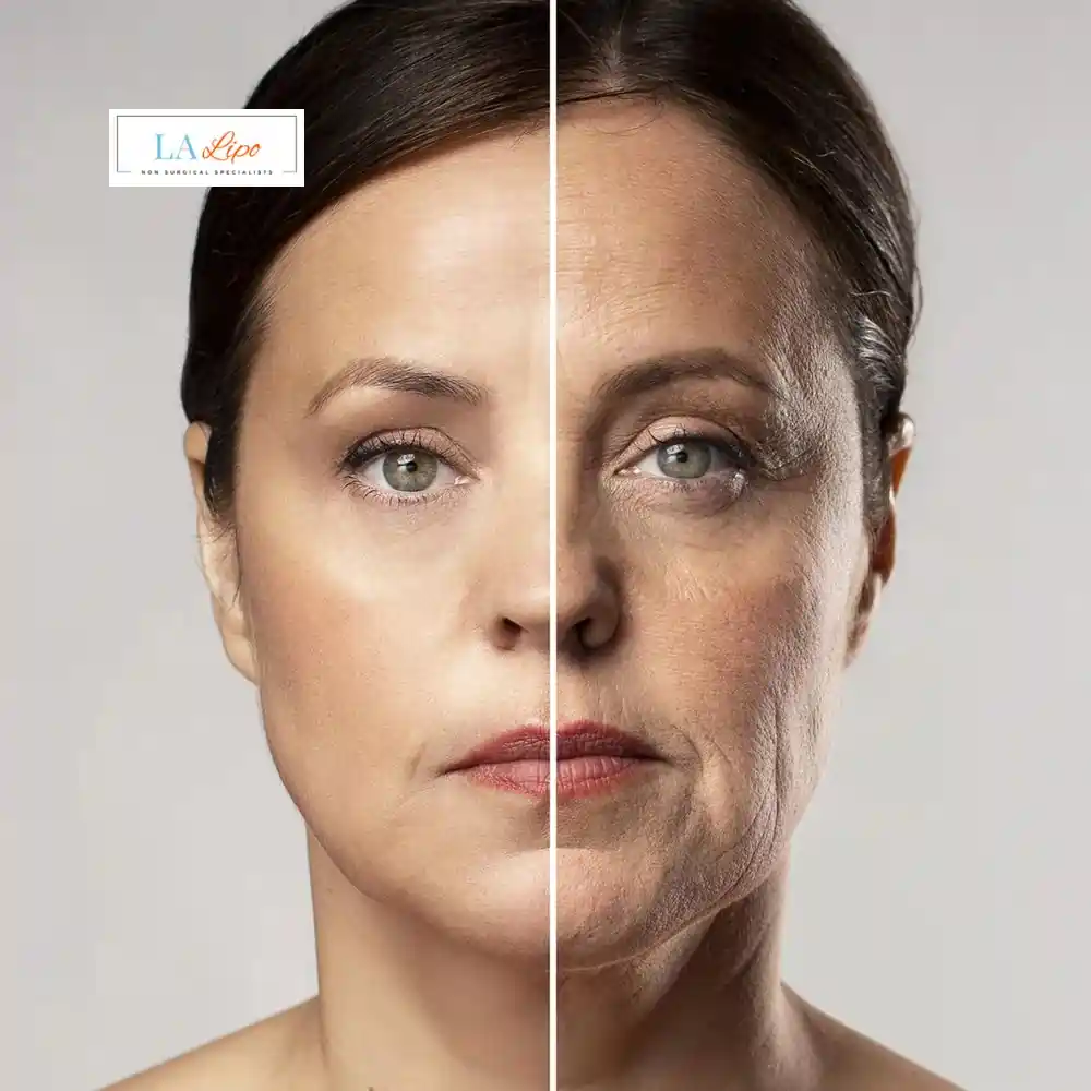 How Can You Tell If Non-Surgical Skin Tightening Is Right for You Gateshead?