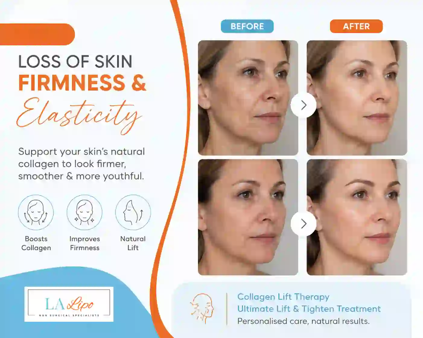 Sign #7: Loss of Skin Firmness and Elasticity Gateshead