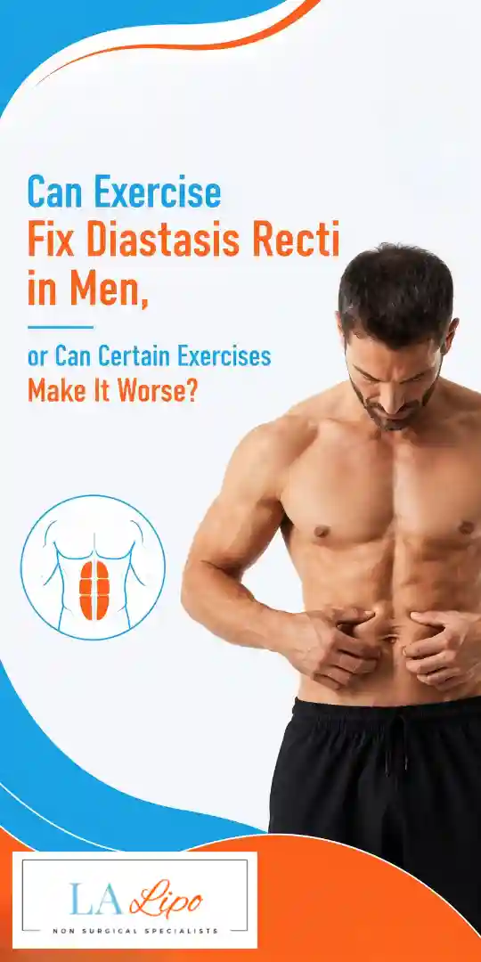 Can Exercise Fix Diastasis Recti in Men, or Can Certain Exercises Make It Worse Gateshead?